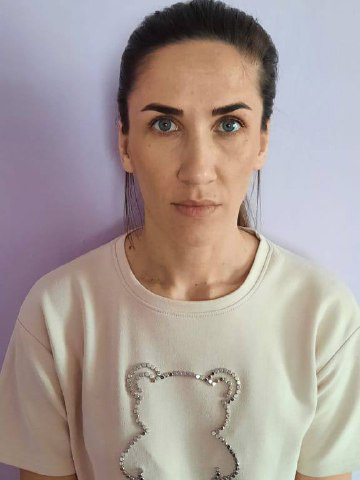 Пластическая операция на уши – фото 2